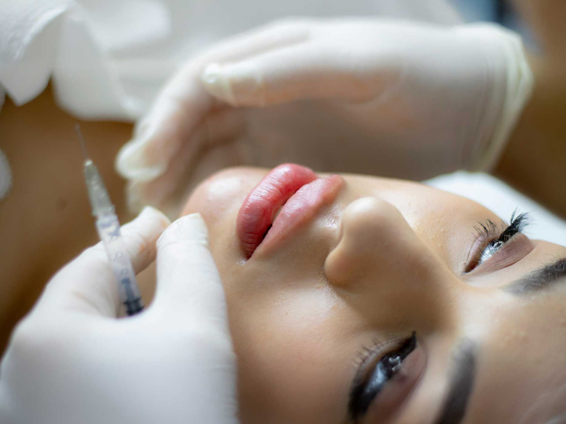 Bild von einer Frau, die auf dem Behandlungstisch liegt und sich die Lippen aufspritzen lässt.